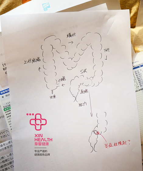 raybet雷竞技公司 XIN HEALTH 日本體檢腸鏡檢查後 醫生為用戶細致圖解說明檢查結果